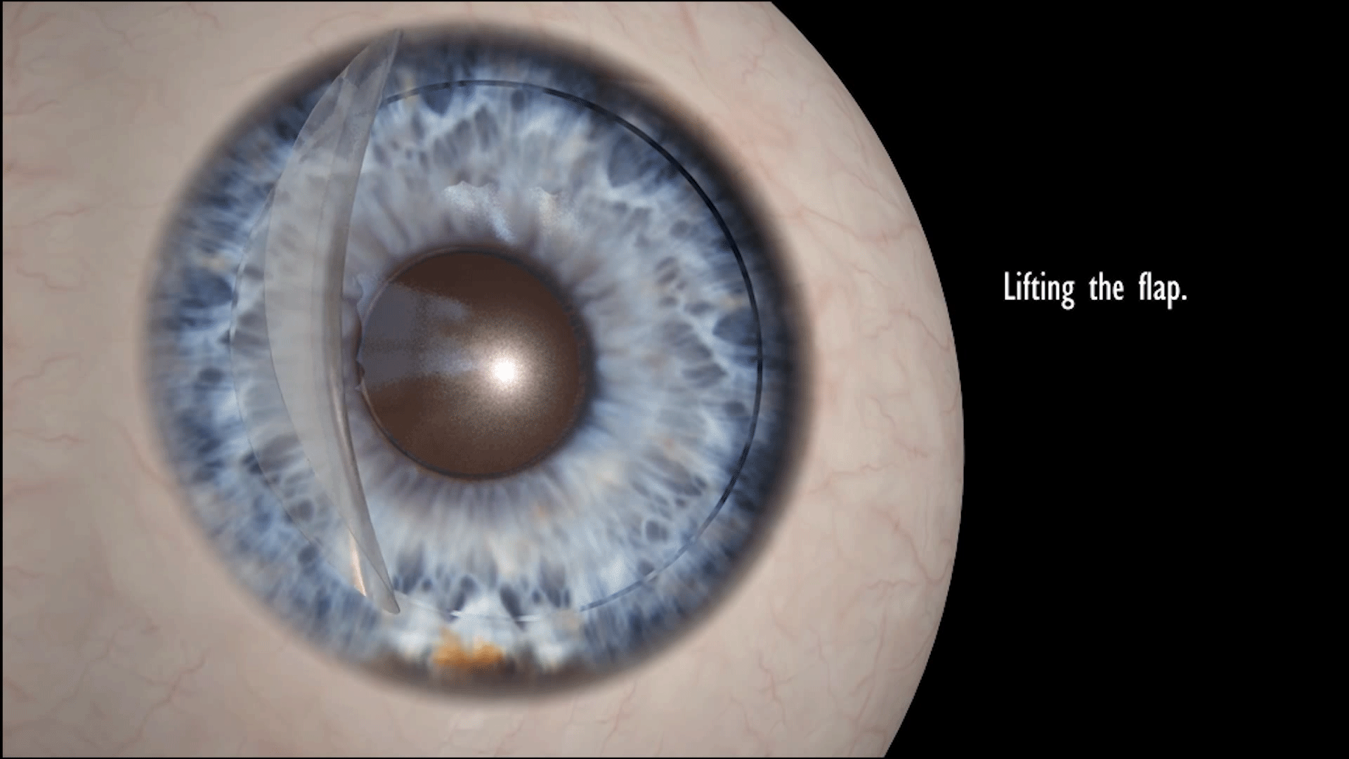 eyeball
