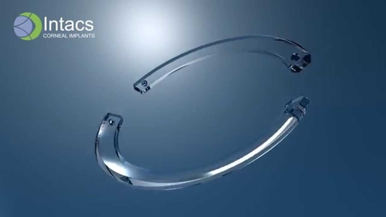 Intacs corneal implants for improved vision correction – Soroudi Advanced LASIK & Eye Centers Los Angeles