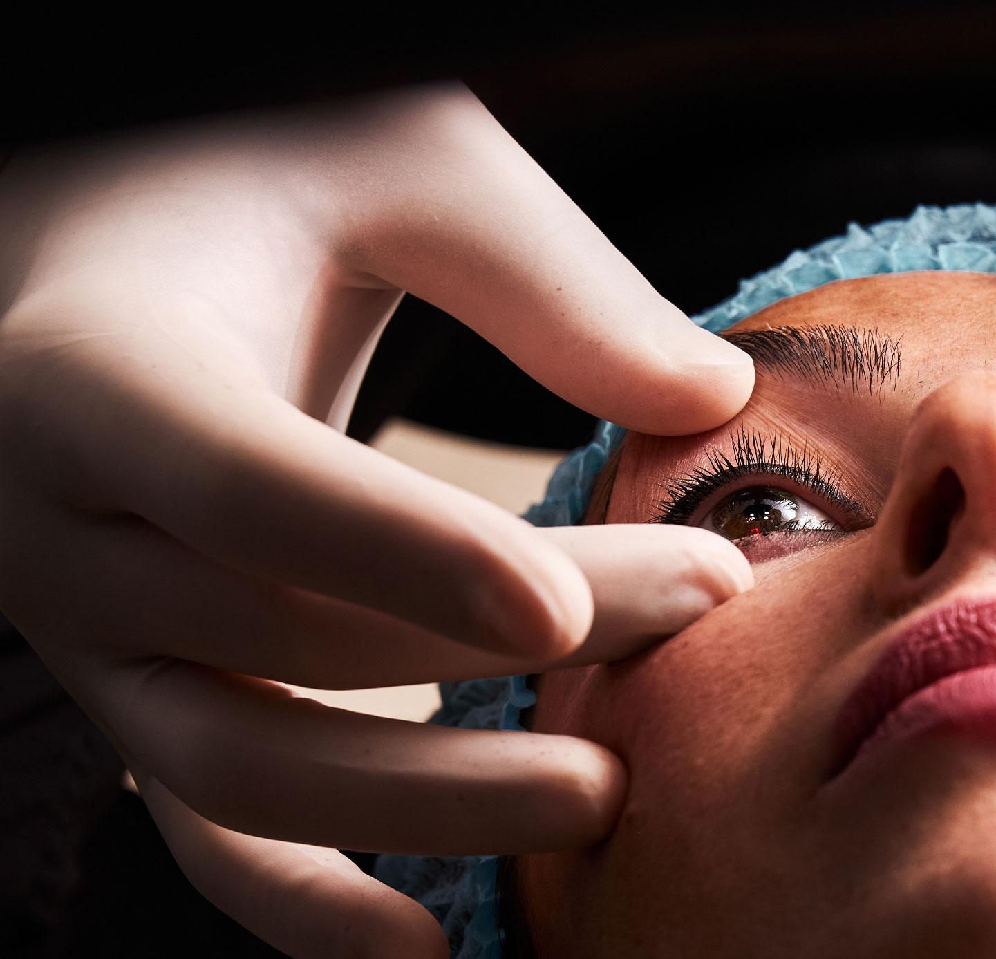 Cataract Removal Surgery Los Angeles - Soroudi Advanced