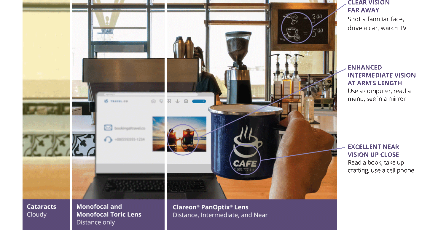 Cataract awareness concept with coffee cup and laptop – Soroudi Advanced LASIK & Eye Centers Los Angeles